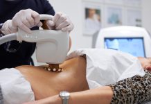 Cellulite Reduction Treatment Unveiling the Secrets to Smooth Skin